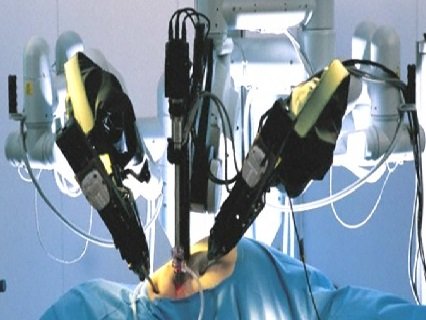 Defying Doubts: Surgical Robots Hold Enormous Future Prospects